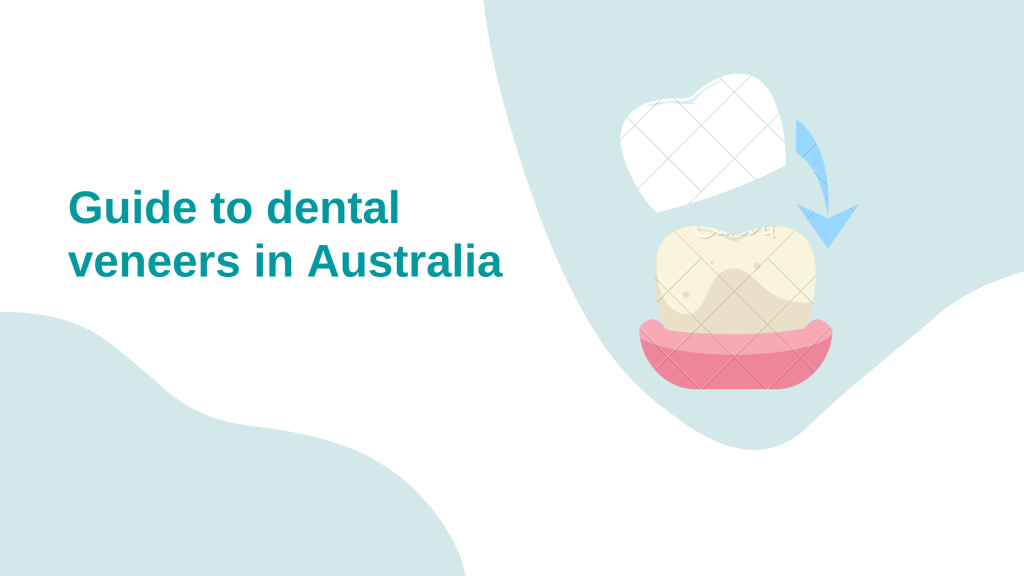 dental veneers guide australia