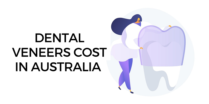 dental veneers cost in Australia