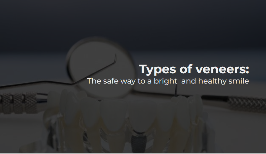 Types of veneers: The safe way to a bright and healthy smile